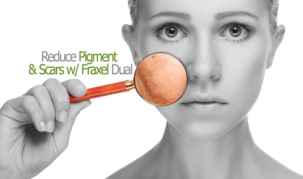 banner-fraxel-pigmentation-m Fraxel 1927 Laser For Pigment Toronto