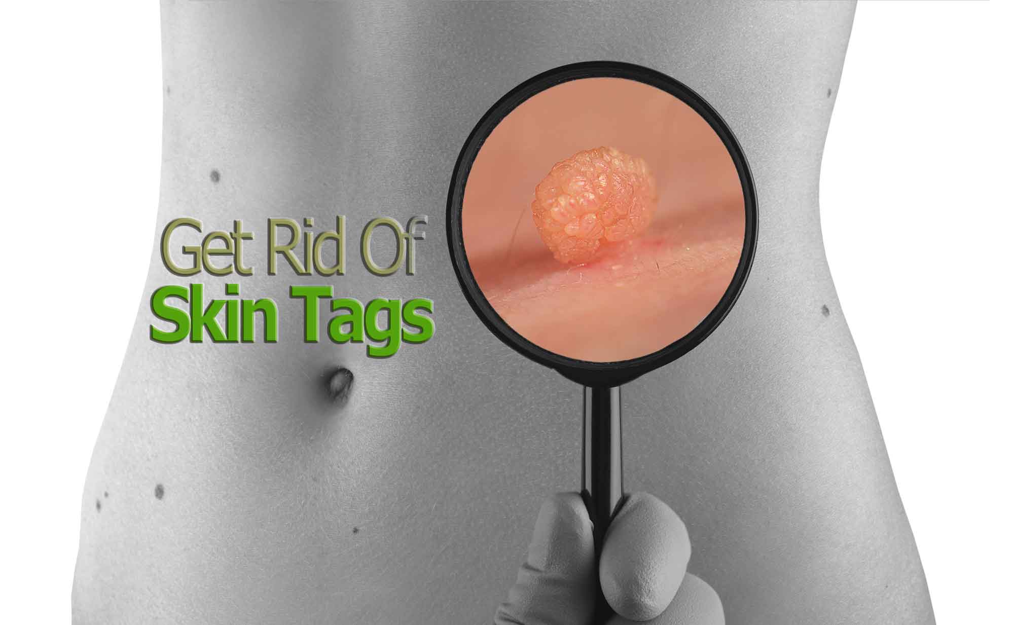 banner-skintag-removal (1) Skin Tag Removal Treatment & Laser Mole removal Treatment in Toronto Banner